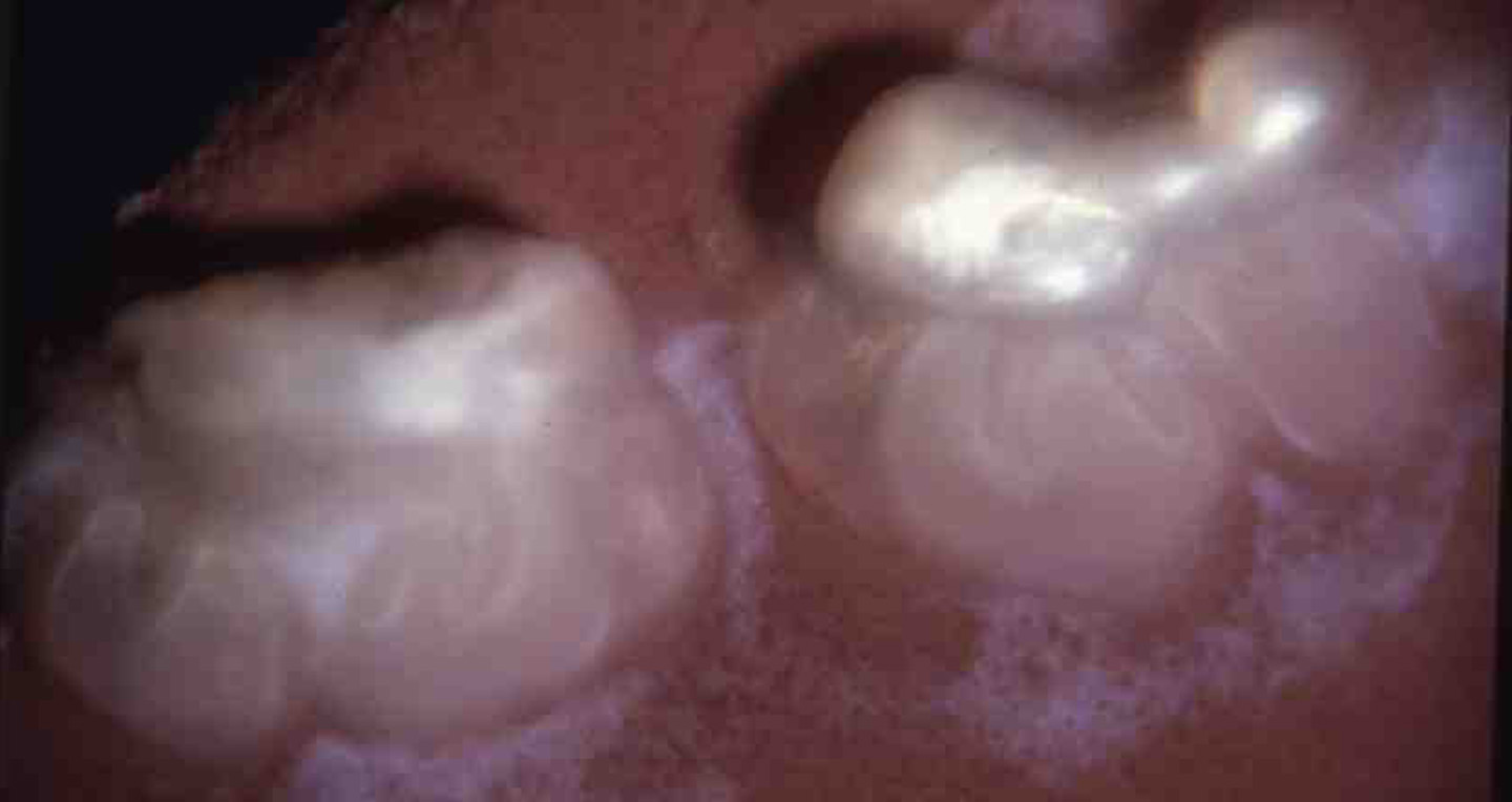 Mouse Tooth Organ Culture